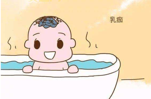 如何清理婴儿乳痂？避免头皮结痂的有效方法