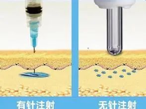 打针搞笑图片_针头消失的注射器_注射器历史演变