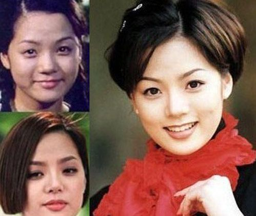 蔡琳离婚后嫁给高梓淇 坦言当中国媳妇轻松 整形后好别扭